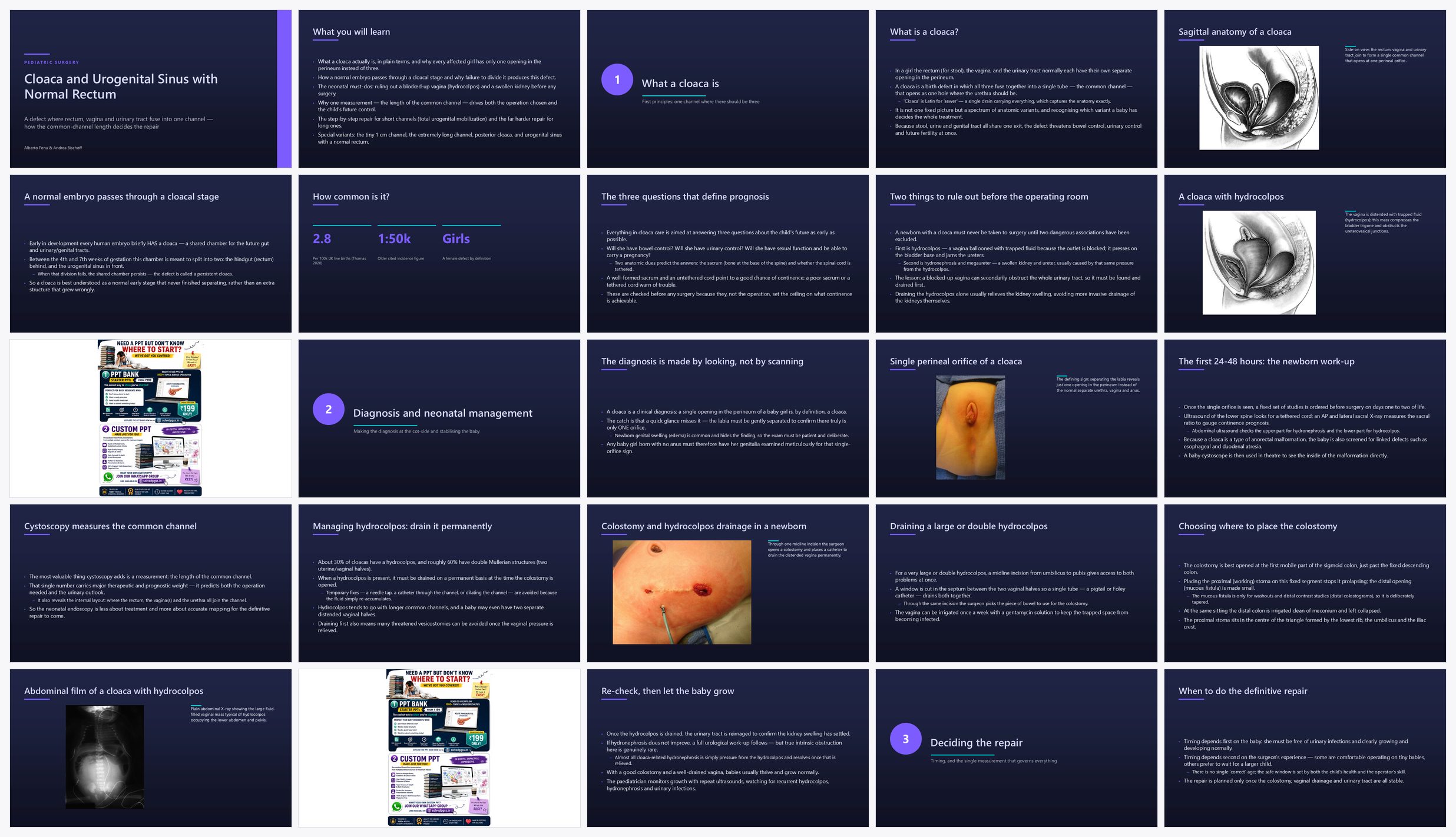 Preview of the first 25 slides of Cloaca and Urogenital Sinus with Normal Rectum