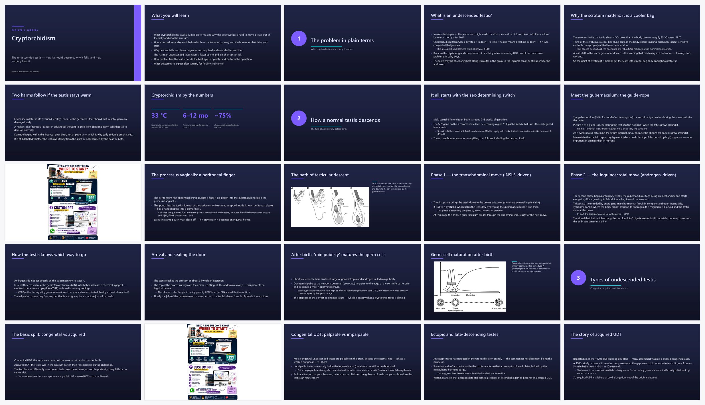 Preview of the first 25 slides of Cryptorchidism