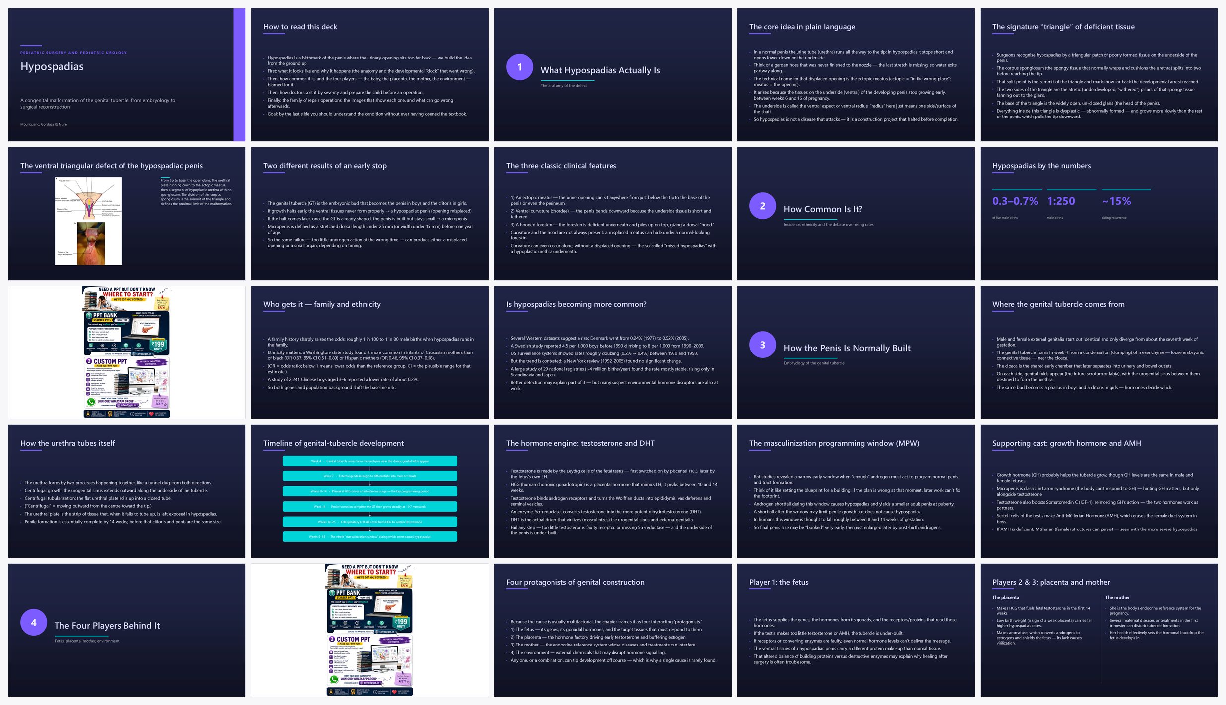 Preview of the first 25 slides of Hypospadias