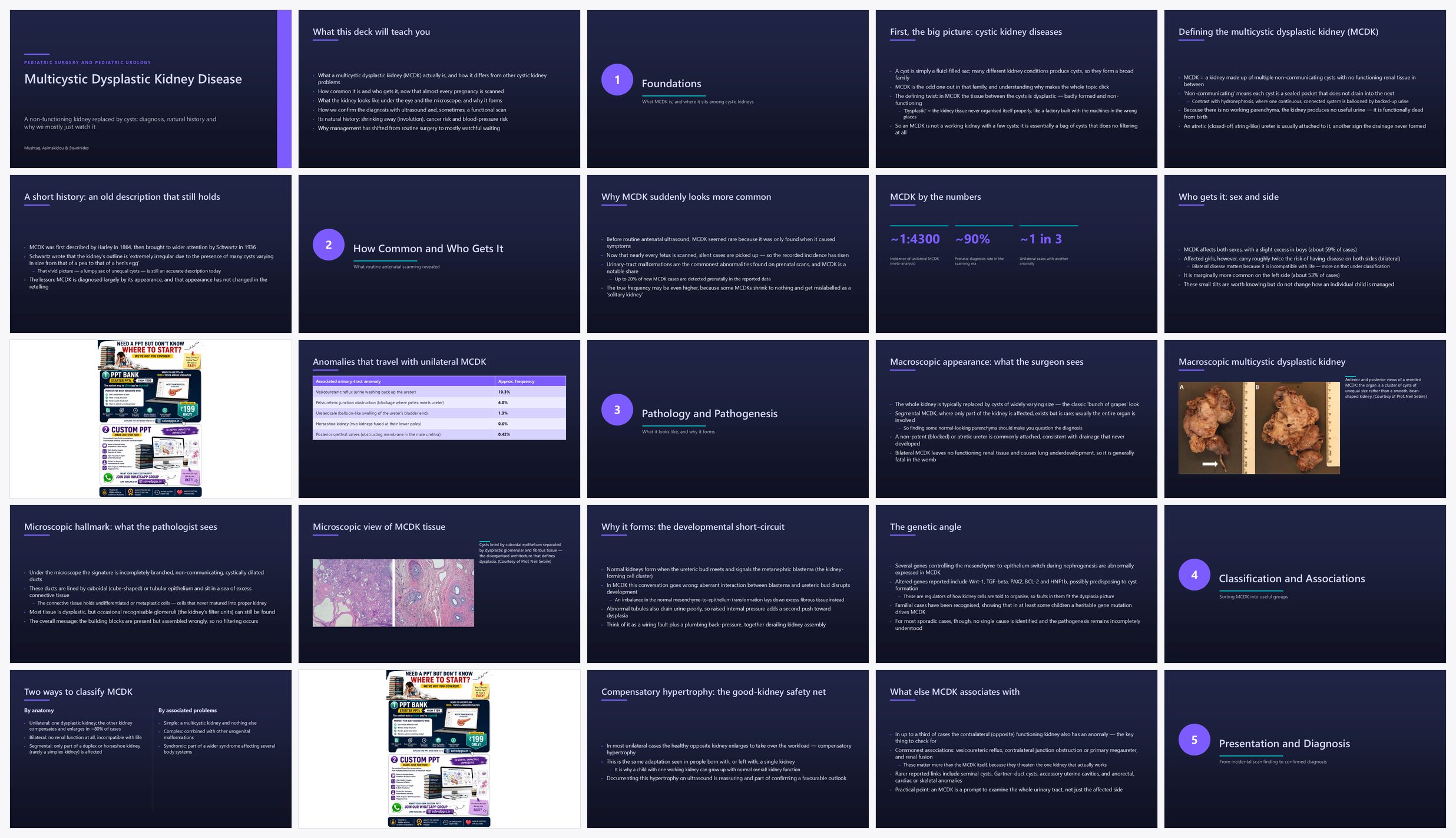 Preview of the first 25 slides of Multicystic Dysplastic Kidney Disease