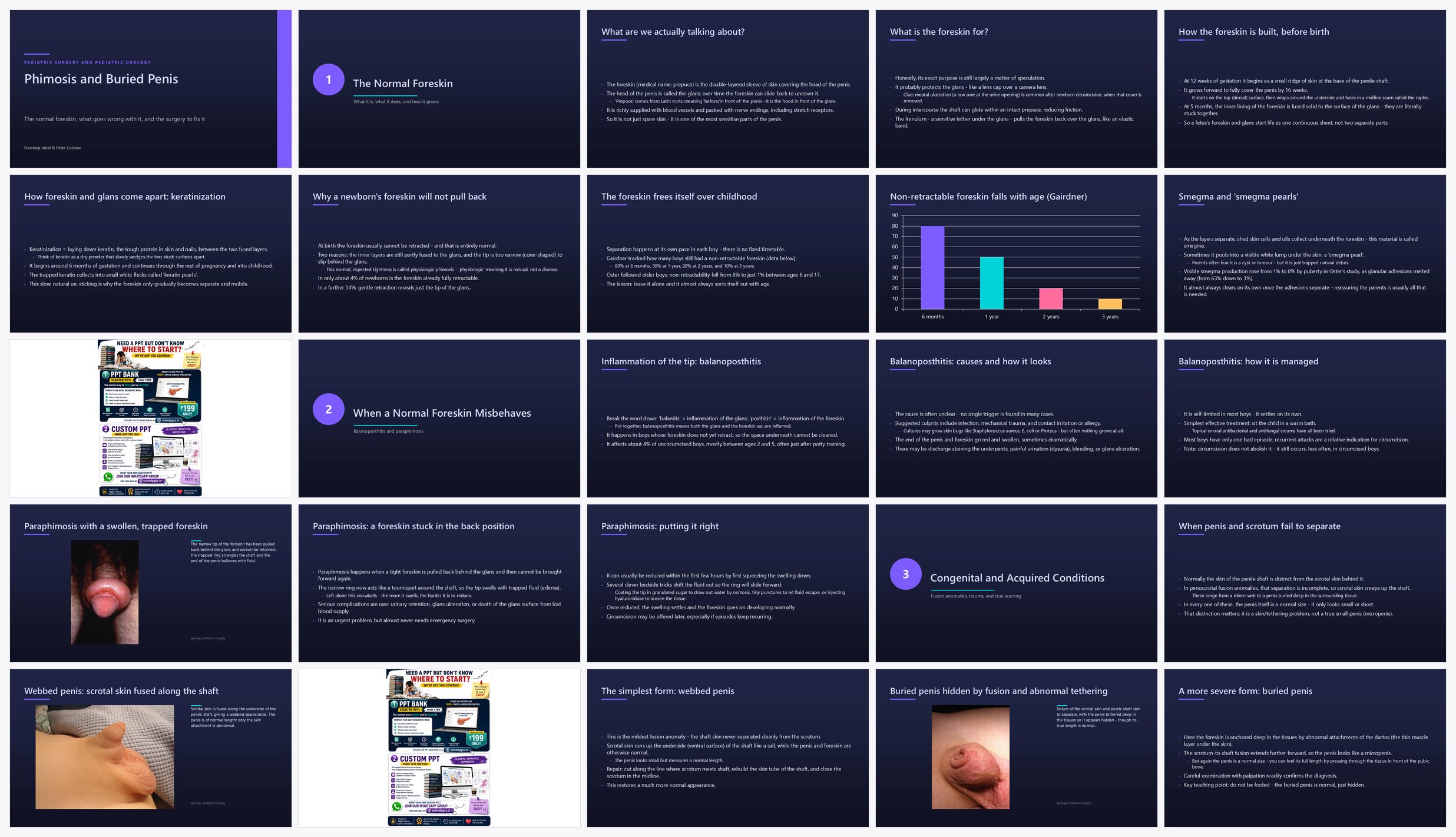 Preview of the first 25 slides of Phimosis and Buried Penis