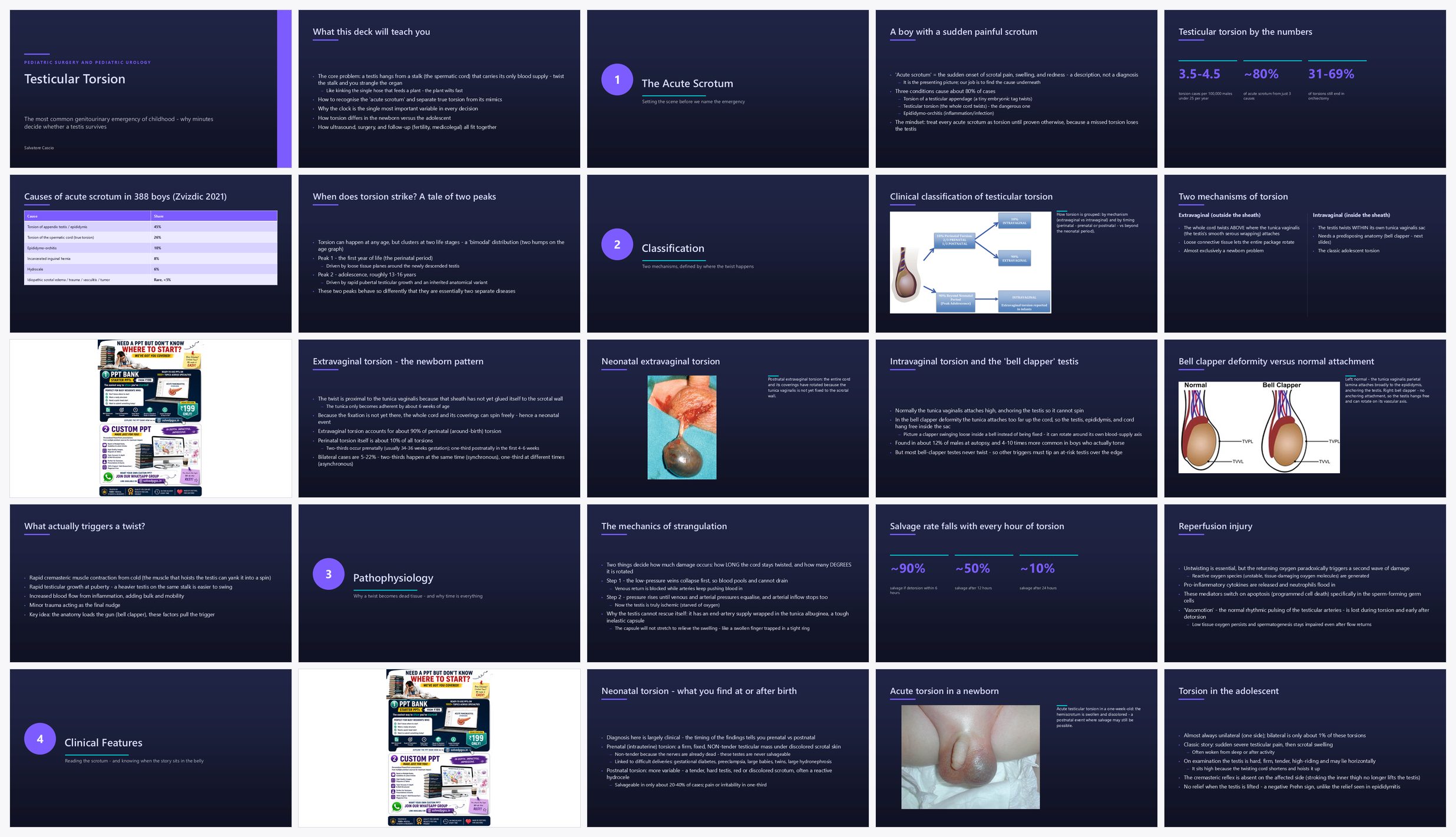 Preview of the first 25 slides of Testicular Torsion