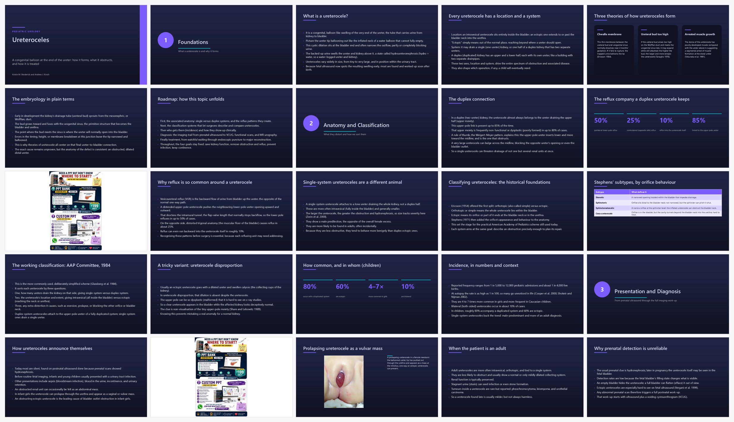 Preview of the first 25 slides of Ureteroceles