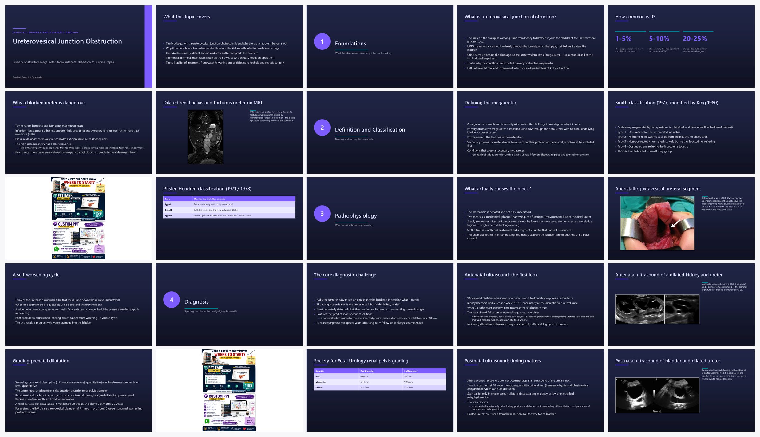 Preview of the first 25 slides of Ureterovesical Junction Obstruction
