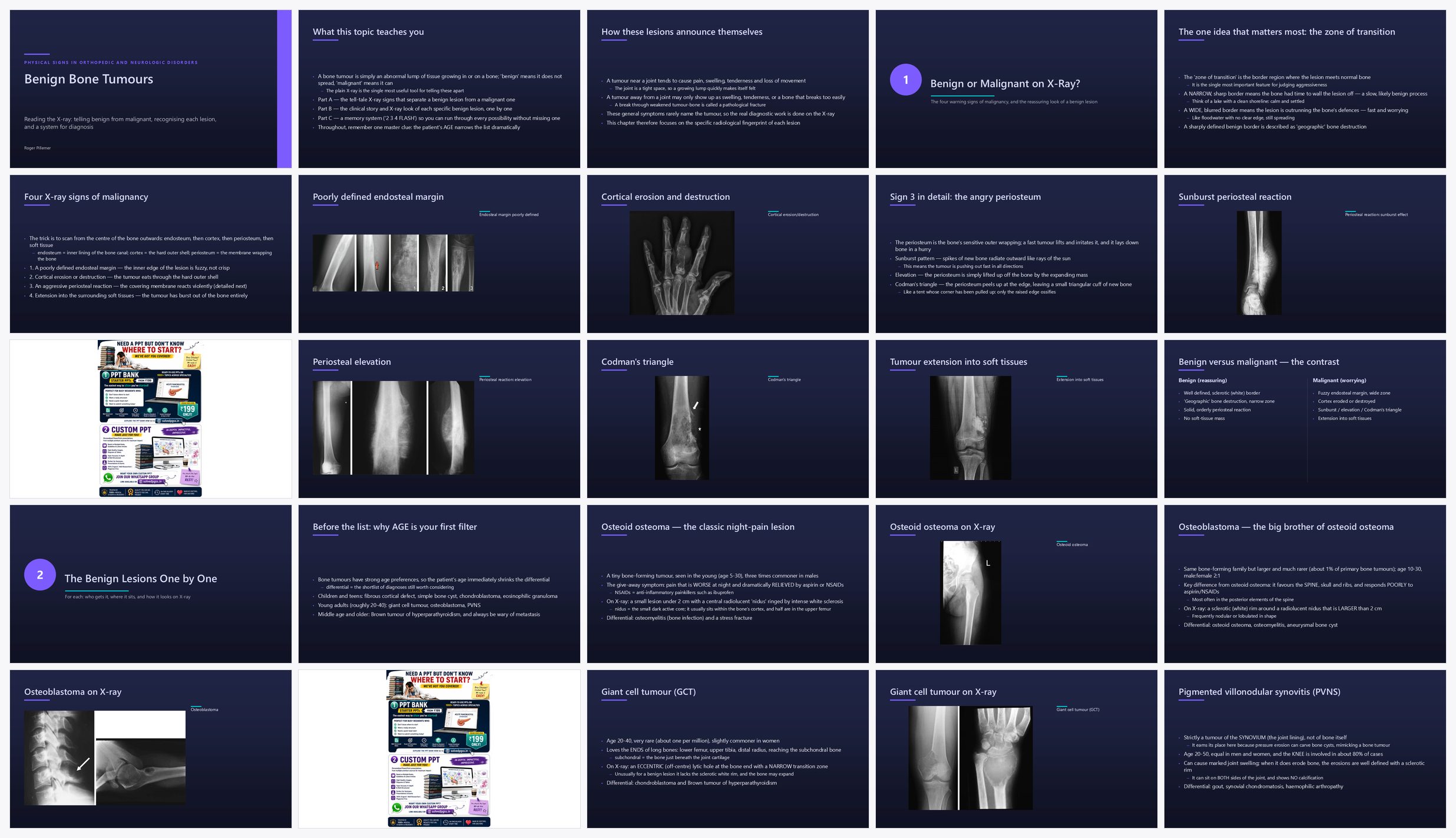 Preview of the first 25 slides of Benign Bone Tumours