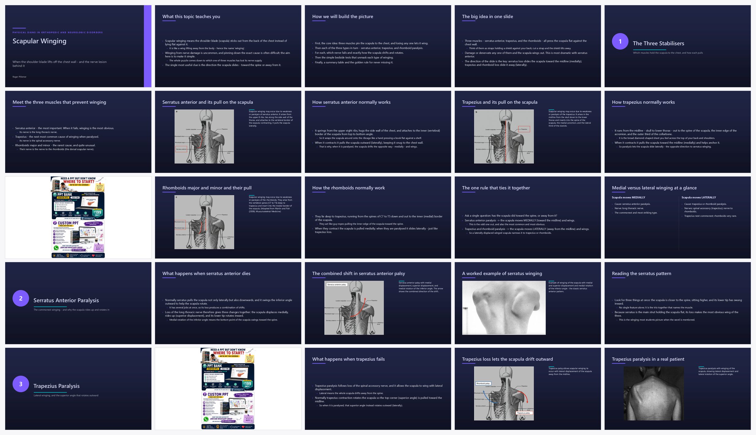 Preview of the first 25 slides of Scapular Winging