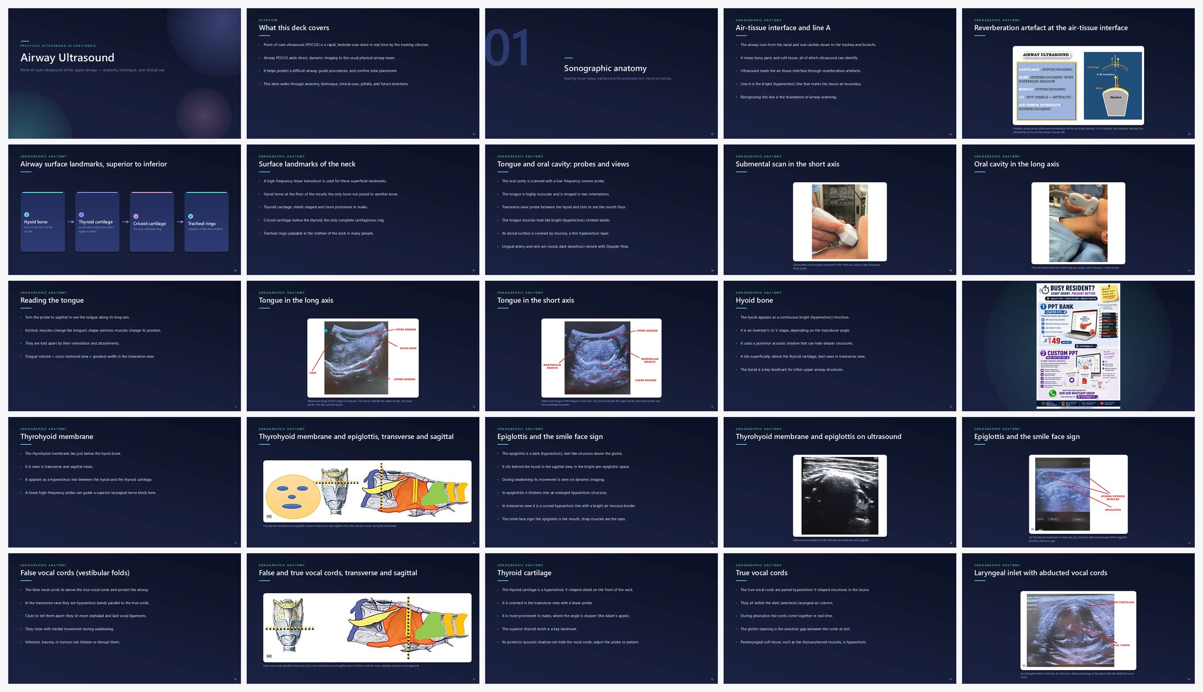 Preview of the first 25 slides of Airway Ultrasound