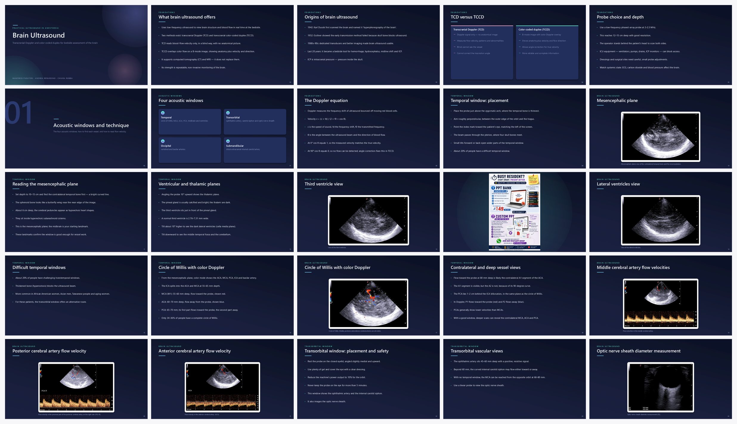 Preview of the first 25 slides of Brain Ultrasound