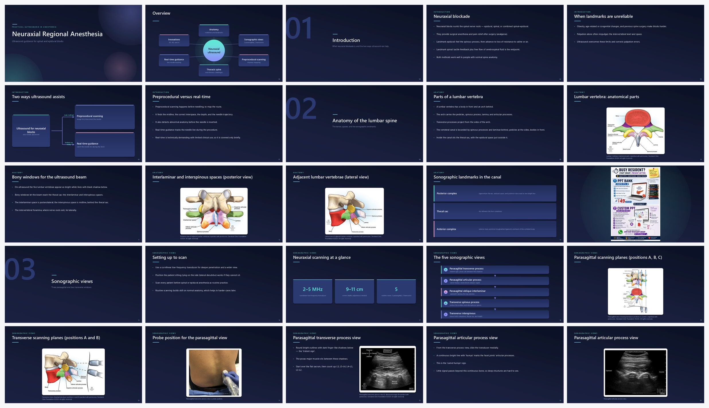 Preview of the first 25 slides of Neuraxial Regional Anesthesia Ultrasound Guidance for Spinal and Epidural Blocks